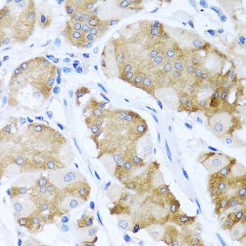 Immunohistochemistry - ACVR1C Polyclonal Antibody (144-00678)