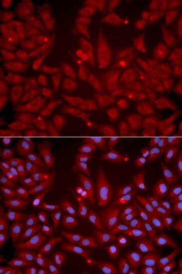 Immunofluorescence - GRIK2 antibody (144-01939)
