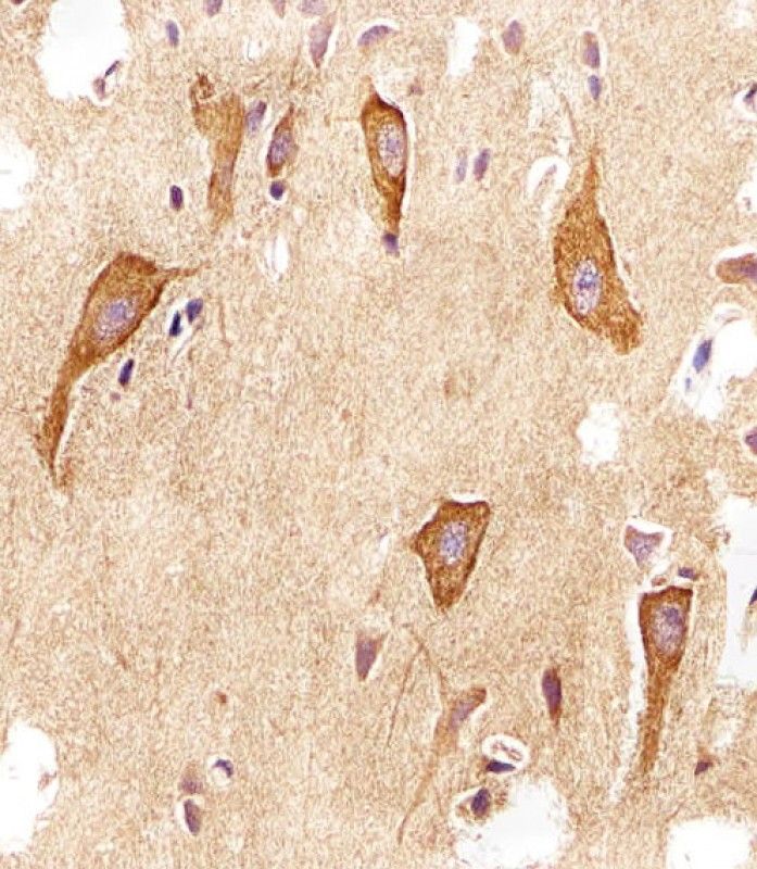 IHC-P