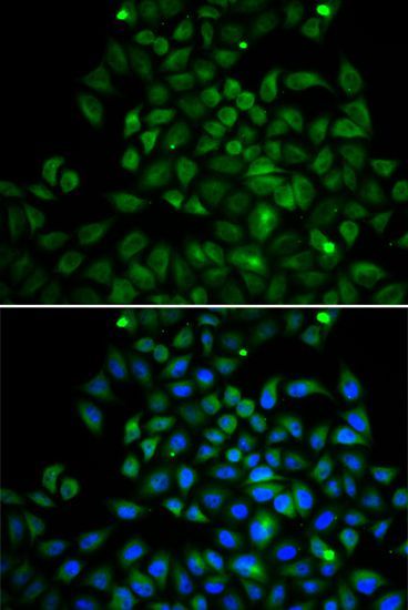 Immunofluorescence - FABP4 Polyclonal Antibody (144-00232)