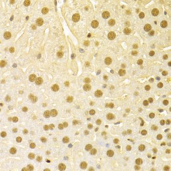 Immunohistochemistry - SFN Polyclonal Antibody (144-01026)