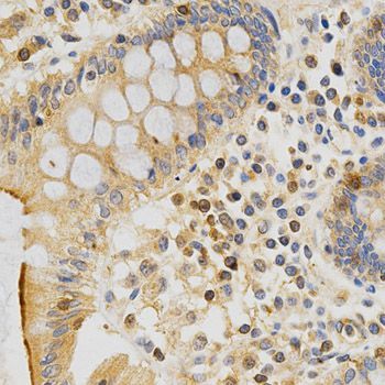 Immunohistochemistry - PRKCE antibody (144-02110)