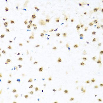 Immunohistochemistry - RAB3IP Polyclonal Antibody (144-08094)