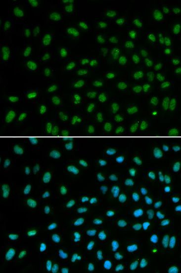 Immunofluorescence - DDB2 antibody (144-01848)