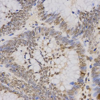 Immunohistochemistry - TriMethyl-Histone H3-K79 pAb (144-61342)