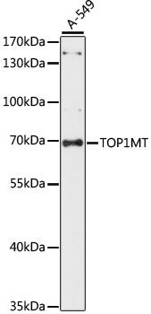 Western blot - TOP1MT antibody (144-61110)