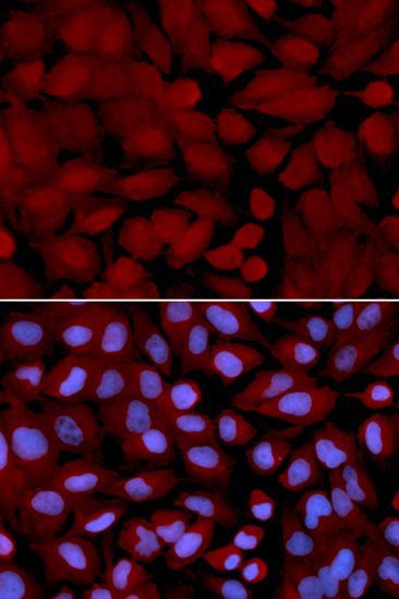 Immunofluorescence - OGT antibody (144-01990)