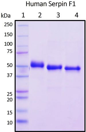 SDS-PAGE