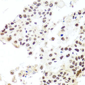 Immunohistochemistry - HIRA antibody (144-08461)