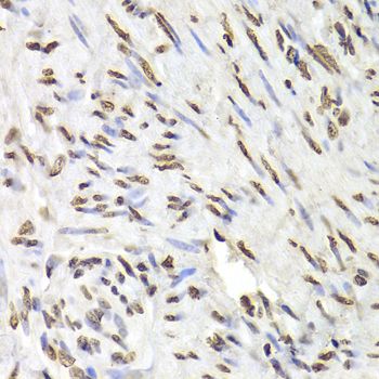 Immunohistochemistry - HNRNPD Polyclonal Antibody (144-01828)