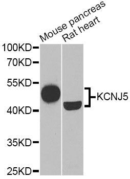 Western blot - KCNJ5 Antibody (144-06232)