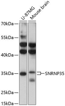 Western blot