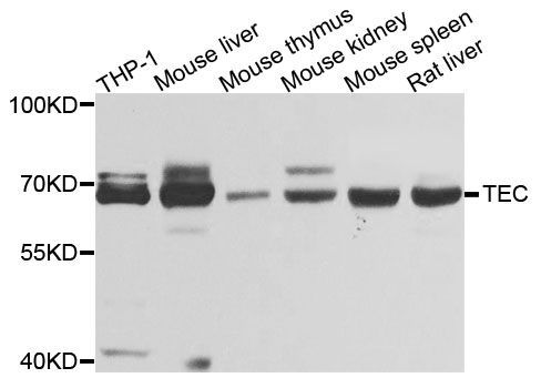 Western blot - TEC Polyclonal Antibody (144-00189)