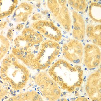 Immunohistochemistry - PDE4DIP antibody (144-07765)