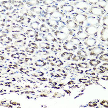 Immunohistochemistry - NUMA1 Polyclonal Antibody (144-00527)