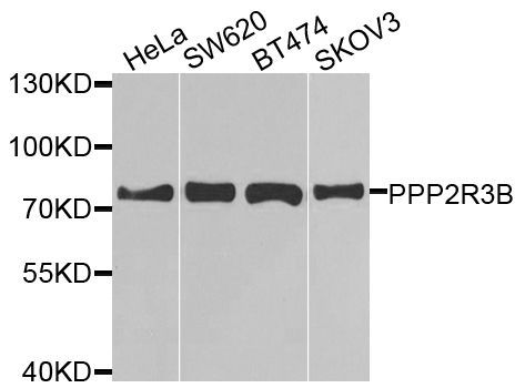 Western blot - PPP2R3B antibody (144-08489)