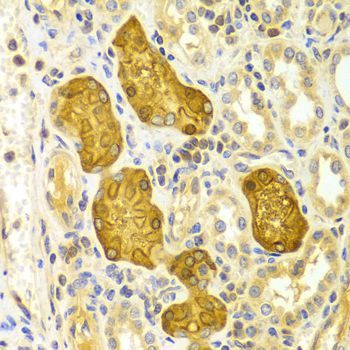 Immunohistochemistry - PRKCE antibody (144-02110)