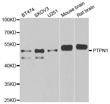 Western blot - [KO Validated] PTPN1 Polyclonal Antibody (144-01590)