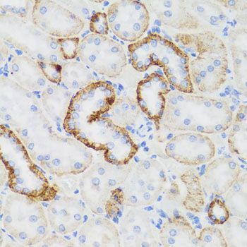 Immunohistochemistry - NEFH antibody (144-08442)