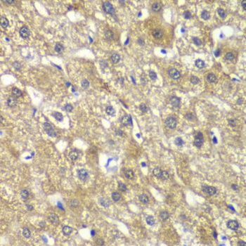 Immunohistochemistry - MYBPC2 antibody (144-60286)