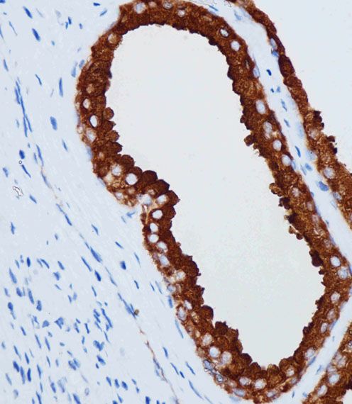 IHC