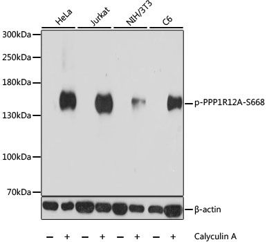 Western blot - Phospho-PPP1R12A-S668 antibody (144-61544)