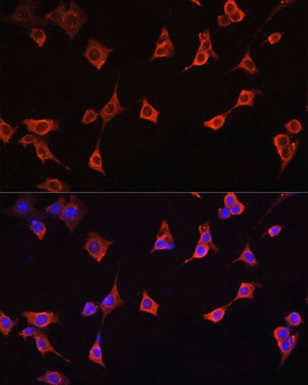 Immunofluorescence - CFL1 antibody (144-01704)