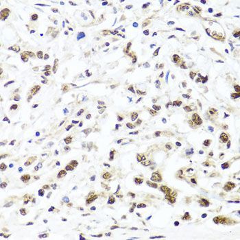 Immunohistochemistry - HIRA antibody (144-08461)