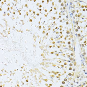 Immunohistochemistry - AKT1 Polyclonal Antibody (144-011016)