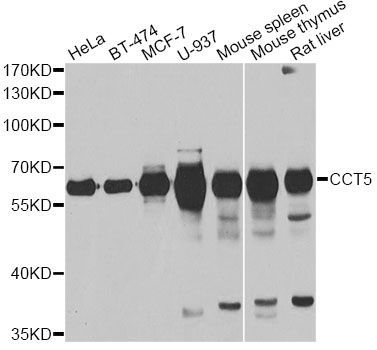 Western blot - CCT5 antibody (144-06549)