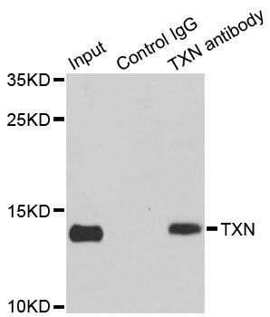 Immunohistochemistry - TXN Polyclonal Antibody (144-07638)