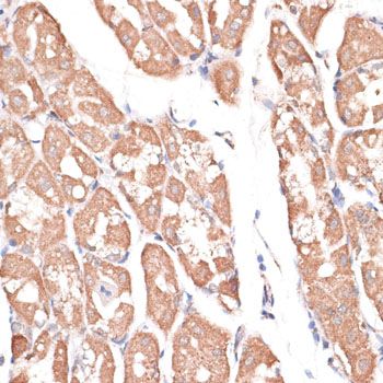 Immunohistochemistry - KIF14 Polyclonal Antibody (144-10275)