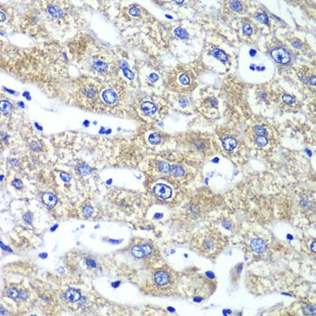 Immunohistochemistry - QARS antibody (144-06960)