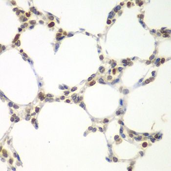 Immunohistochemistry - VRK1 Polyclonal Antibody (144-07745)