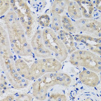 Immunohistochemistry - STK3 Polyclonal Antibody (144-06992)