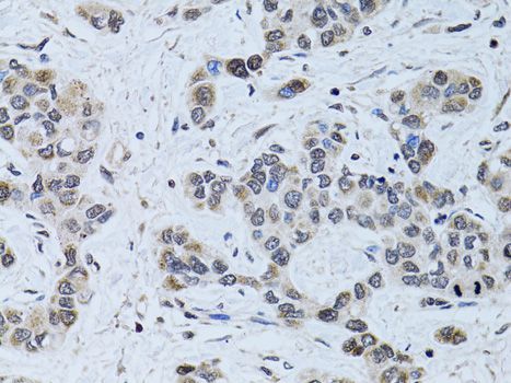 Immunohistochemistry - SIN3A antibody (144-60522)
