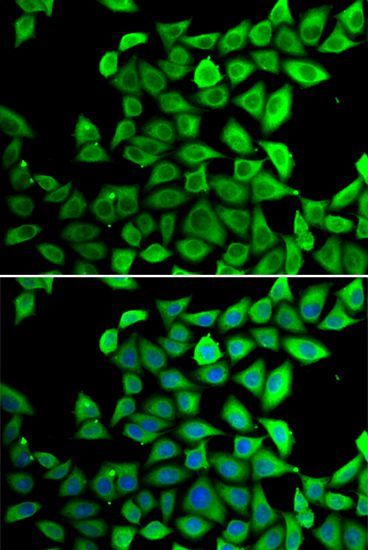 Immunofluorescence - PPID Polyclonal Antibody (144-06949)