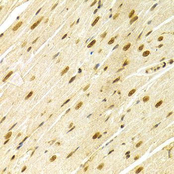 Immunohistochemistry - MAPK3 Polyclonal Antibody (144-00228)