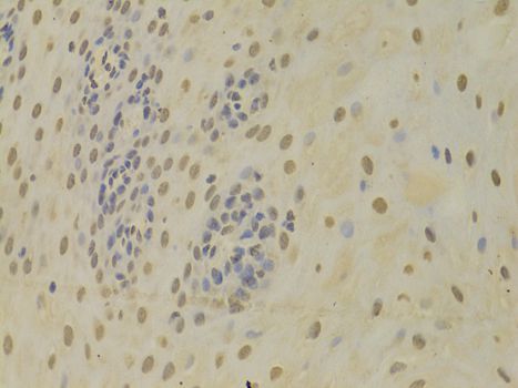Immunohistochemistry - HNRNPK Antibody (144-01701)