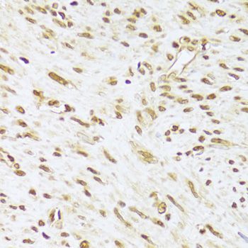 Immunohistochemistry - ANP32A Antibody (144-05768)