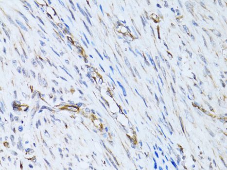 Immunohistochemistry - SELE Antibody (144-02191)