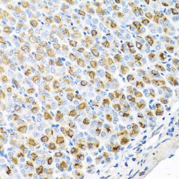 Immunohistochemistry - FECH antibody (144-08418)