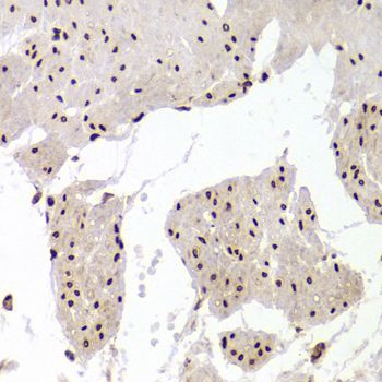 Immunohistochemistry - XRCC6 Polyclonal Antibody (144-00883)