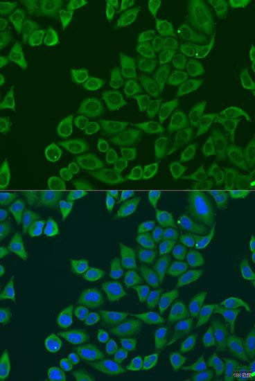 Immunohistochemistry - RPL36 Polyclonal Antibody (144-07793)