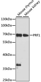 Western blot - PRF1 Polyclonal Antibody (144-00093)