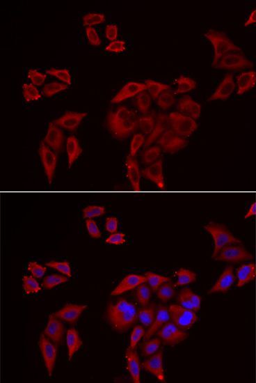 Immunofluorescence - P2RX4 Polyclonal Antibody (144-06682)