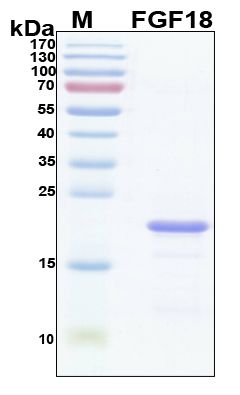 SDS-PAGE image