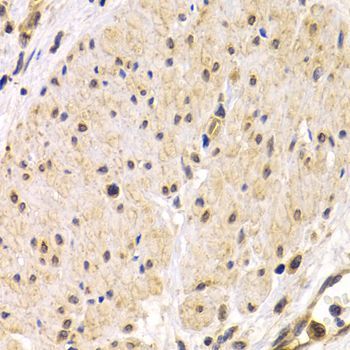 Immunohistochemistry - TMPRSS2 antibody (144-01979)