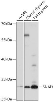 Western blot