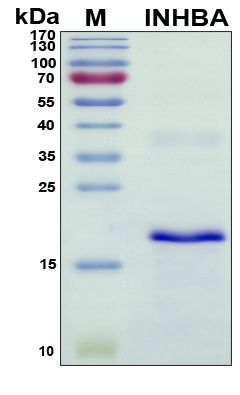 SDS-PAGE